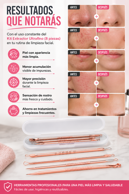 Kit de Pinzas Ultrafinas para Espinillas 8 Piezas - Limpieza profesional sin salir de casa