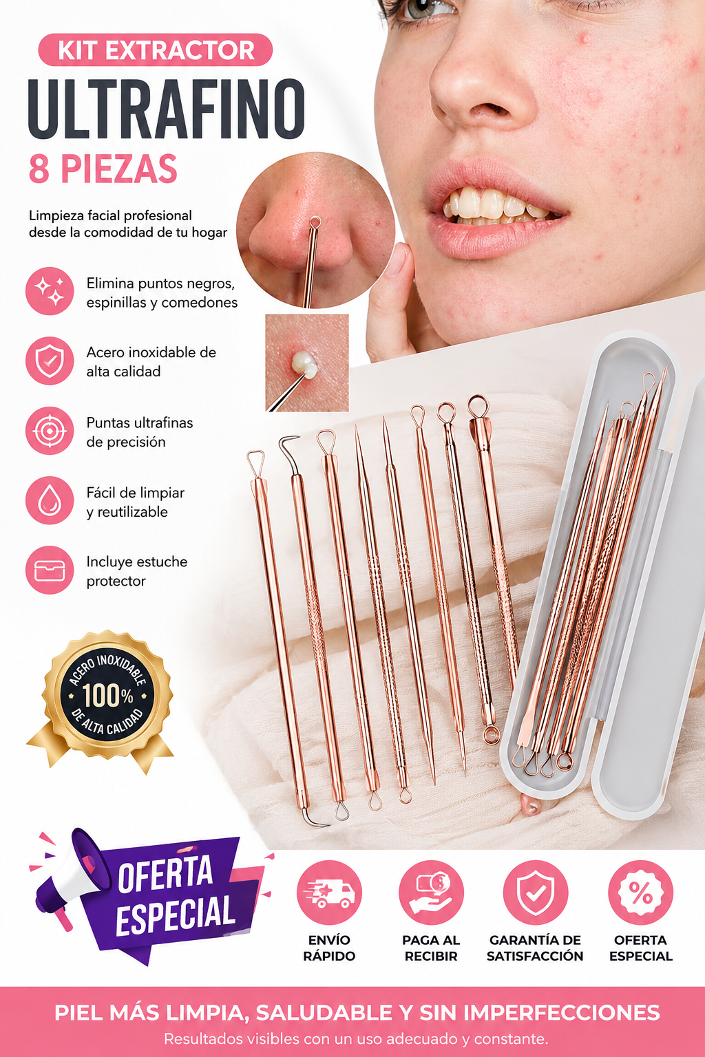 Kit de Pinzas Ultrafinas para Espinillas 8 Piezas - Limpieza profesional sin salir de casa